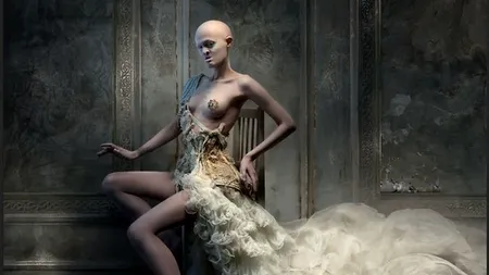 
Povestea tinerei care a reușit să treacă peste boala de care suferă și să devină celebră în lumea modei