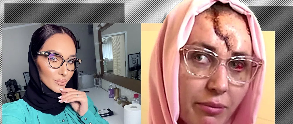 VIDEO | Imagini șocante cu Dana Roba, după ce a fost bătută de soțul ei! ”Nu-mi vine să cred cum am arătat și cum arăt acum”