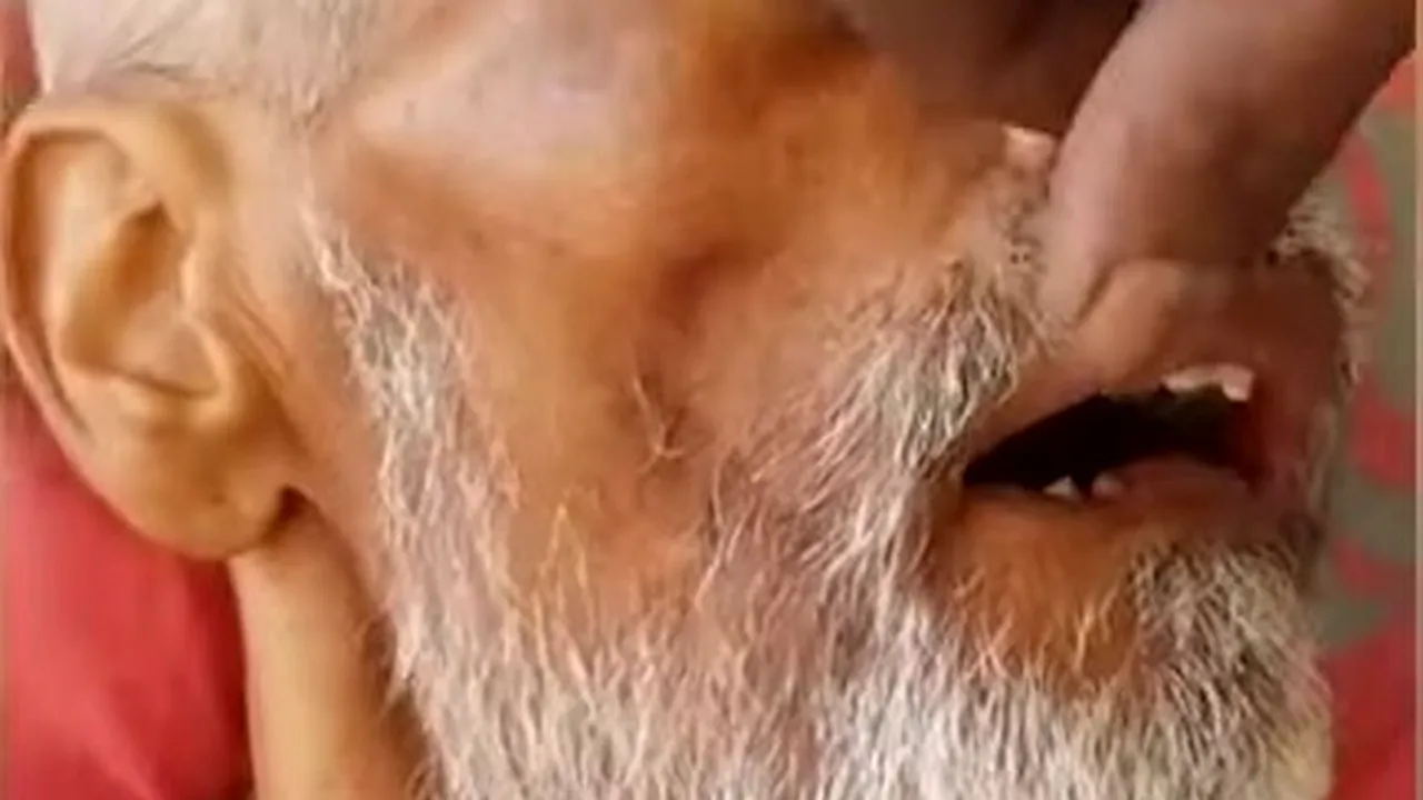 Neglijență dusă la extrem: M-au asigurat că vor avea grijă de el, inclusiv de igienă, dar îi mișunau prin gură. Ce a descoperit bărbatul când și-a vizitat tatăl la spital - VIDEO