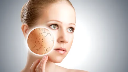 Cum putem scăpa de pielea uscată