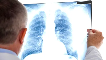 Medic, despre criza sanitară din Cluj : Nu sunt nicăieri paturi de terapie intensivă