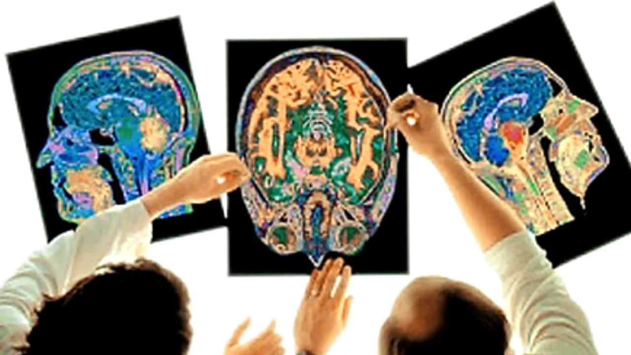 STUDIU. Vârsta la care creierul ajunge la maturitate