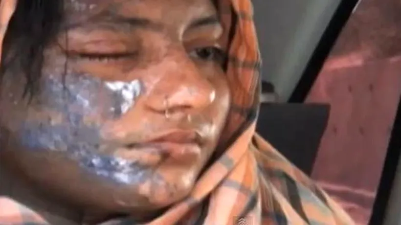 VIDEO. O cântăreață din Pakistan, în stare critică, după ce a fost atacată cu acid: A fost cerută în căsătorie dar l-a refuzat