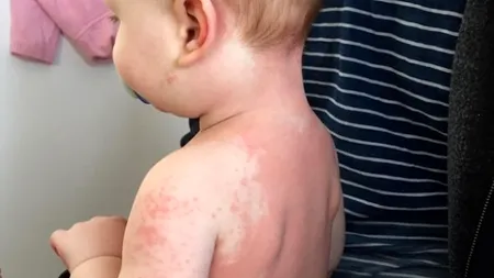 SFÂȘIETOR. Mama unui copil decedat din cauza sindromului Kawasaki, corelat cu noul coronavirus, avertisment dur pentru părinți: Fiți vigilenți!