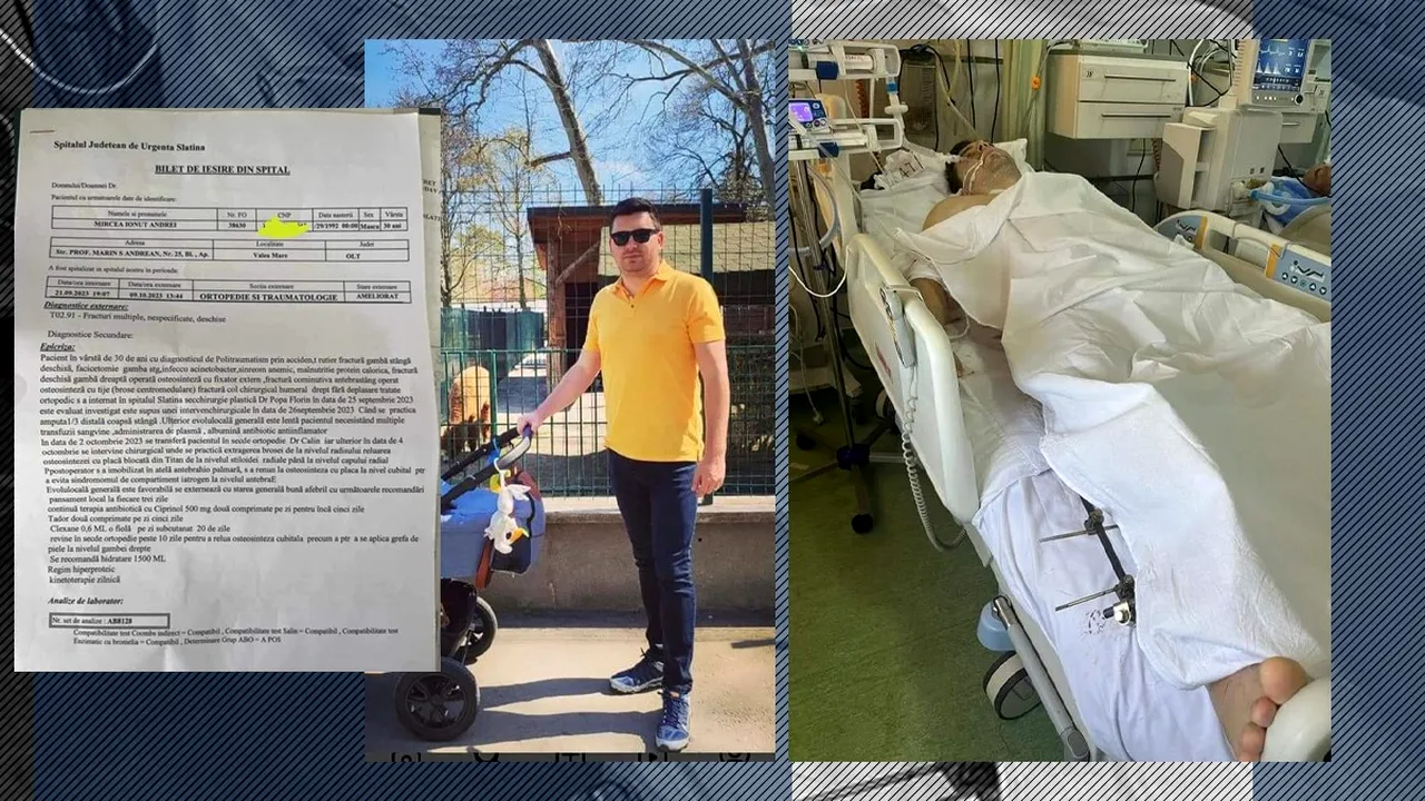 Apel umanitar: Un polițist are nevoie de bani pentru o proteză, după ce un șofer inconștient l-a lovit în plin / Piciorul drept i-a fost AMPUTAT