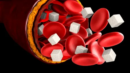 6 CONDIMENTE salvatoare pentru diabetici. Curăță zahărul din vasele de sânge!