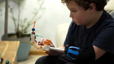 Povestea impresionantă a băiatului de 9 ani care și-a construit  singur o proteză din piese Lego