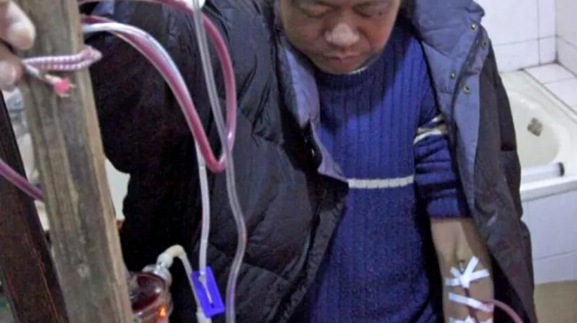Un chinez a făcut dializă folosind un aparat pe care l-a construit singur. FOTO