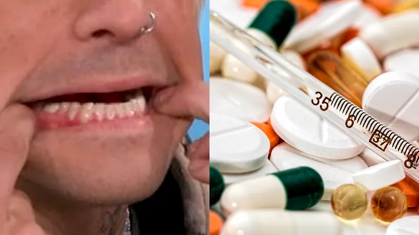 Un cântăreț celebru a recunoscut că suferă de schizofrenie și ia zilnic un pumn de pastile. „Aceasta este realitatea mea VIDEO
