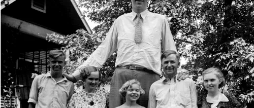 Povestea celui mai înalt bărbat din lume. De ce a murit la numai 22 de ani