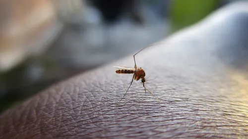Cum poți trata înțepăturile de țânțari. Ce spun specialiștii