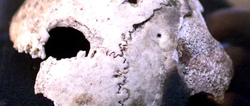 Două cranii umane, găsite la groapa de gunoi a unui sat din Iași
