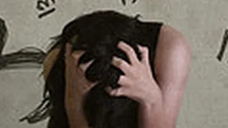 O româncă suferă de una dintre cele mai ciudate boli din lume