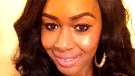 O angajată de la Victoria's Secret, desfigurată în plină stradă cu acid