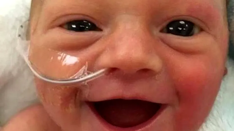 Născut prematur, a fost numit cel mai fericit bebeluș din lume. Fotografia care a emoționat o lume întreagă  