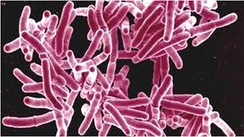STUDIU. Milioane de cazuri de tuberculoză pot exploda din cauza măsurilor restrictive, în următorii ani