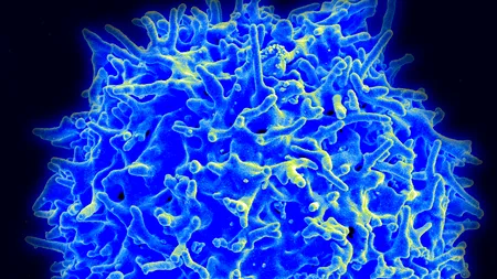 Adrenalina eliberată în timpul exercițiilor fizice poate micșora tumorile cu până la 50%