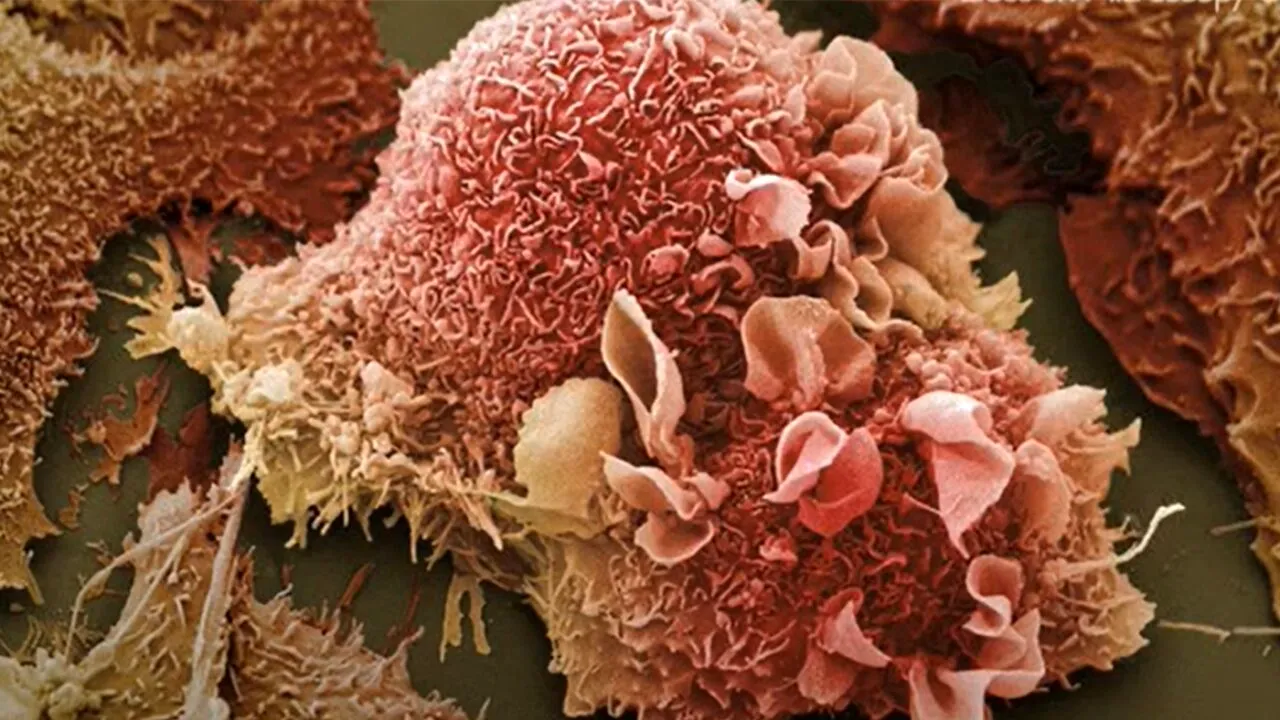 Cum arată CANCERUL, de fapt. Este total diferit de ceea ce poate că ne-am imaginat