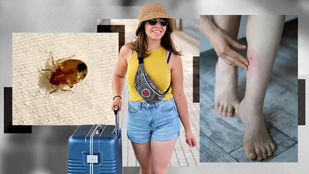 Atenție unde dormiți când mergeți în vacanță! Specialiștii avertizează că avem invazie de ploșnițe, aduse acasă din spații de cazare neigienizate