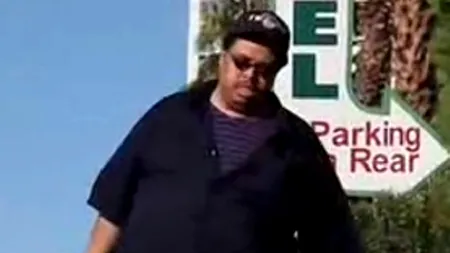 Boala inimaginabilă de care suferă un american: 