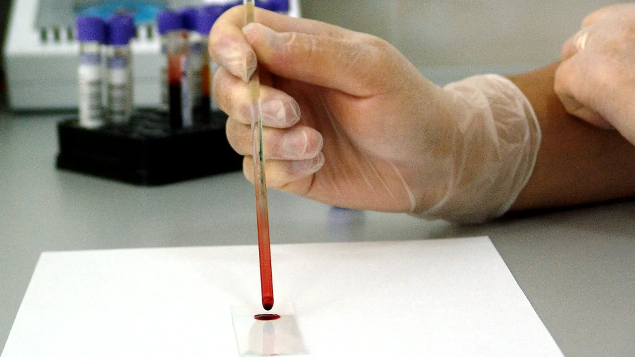 Când trebuie să testăm pentru colesterol copiii mai mici de 10 ani 