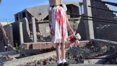 Bărbat ce truca fotografii cu copii răniți și le prezenta ca fiind din Alep, reținut în Egipt