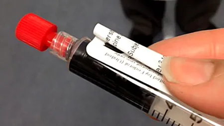 Cercetătorii au descoperit un nou mod de a diferenția celulele canceroase