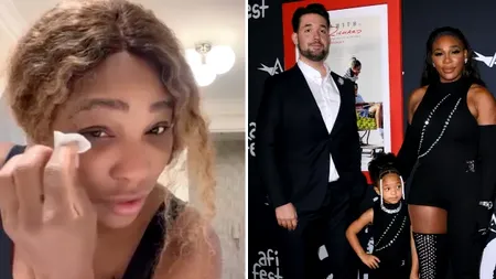 Fanii Serenei Williams, îngroziți. Sportiva a dezvăluit modul „CIUDAT” în care își tratează arsurile solare: „La mine și la copiii mei funcționează”