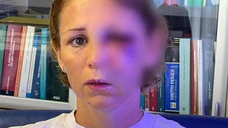 Româncă bătută într-un magazin din Italia. Nimeni nu a sărit în apărarea ei