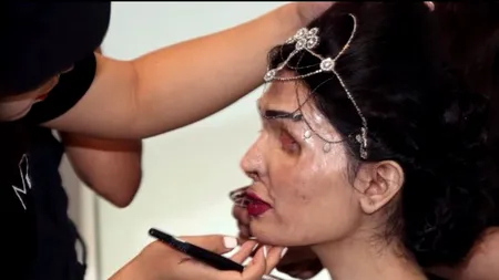 A supraviețuit unui atac cu acid. Acum face furori pe podiumul din New York