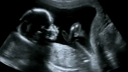 O femeie însărcinată s-a dus să își facă un RMN, dar s-a îngrozit! Imaginile au fost terifiante