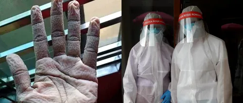 Imagini impresionante ale efectelor pe care le au echipamentele de protecție asupra medicilor din prima linie „A sta îmbrăcat în acel costum te costă”