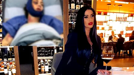 Răsturnare de situație în cazul bătăii încasate de Daniela Crudu duminică noaptea. Ce s-a întâmplat de fapt. Vedeta a rupt tăcerea