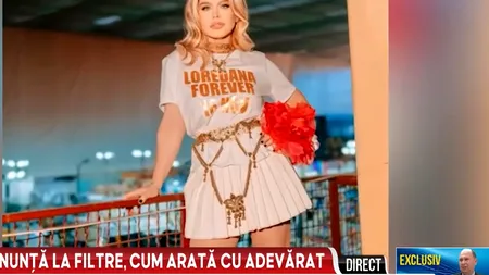 Cum arată, în realitate, Loredana Groza. Vedeta a postat imagini fără FILTRE de înfrumusețare pe Internet