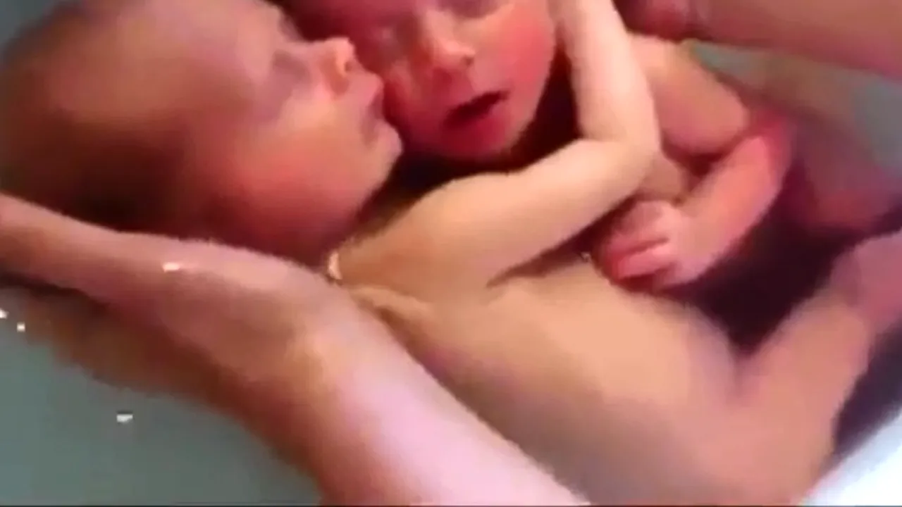 Gemenii care au uimit internetul. Cum au reacționat imediat după naștere