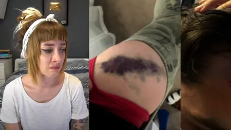 ȘOCANT. Celebră vloggeriță din România, snopită în bătaie în plină stradă de un dezvoltator imobiliar: Țipam, plângeam și absolut nimeni nu mă ajuta! - VIDEO