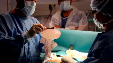 Un chirurg plastician și-a creat femeia perfectă și a luat-o de soție