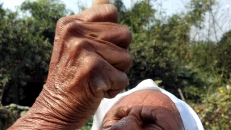 A mâncat 63 de ani ceva interzis, dar nu a ajuns niciodată la doctor. Cum arată acum femeia cu un obicei bizar