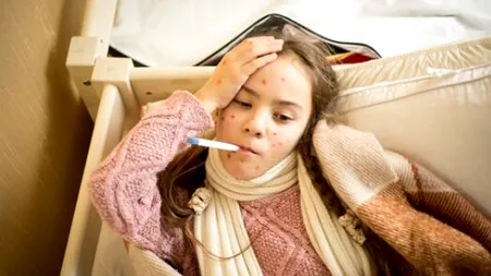 OFICIAL. Epidemie de rujeolă în România. Ministerul Sănătății raportează aproape 2.000 de cazuri în 29 de județe