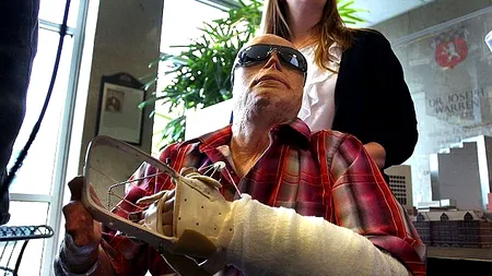 După 120 de intervenții chirurgicale suferite, acest bărbat și-a găsit sufletul pereche