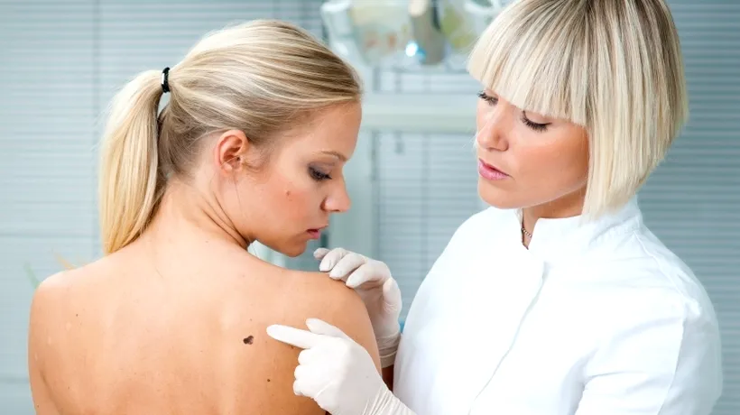 Testare gratuită pentru depistarea cancerului de piele, în Parlament