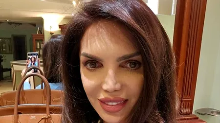 FOTO / Cristina Spătar, despre OPERAȚIILE estetice. ”Să vezi cât de mult te schimbă”