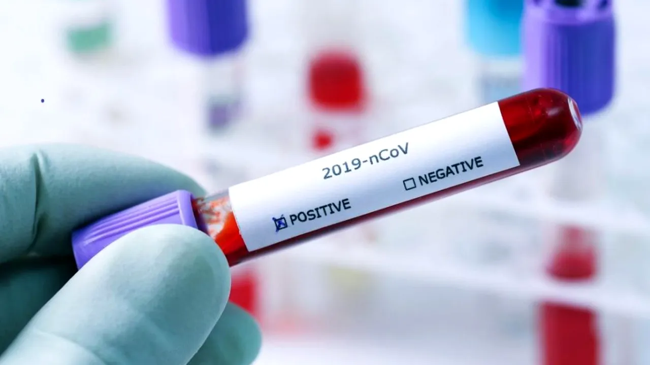 CORONAVIRUS. Focar de Covid-19 la o firmă din Alba! 27 de angajați, testați pozitiv! Măsuri dure luate de DSP