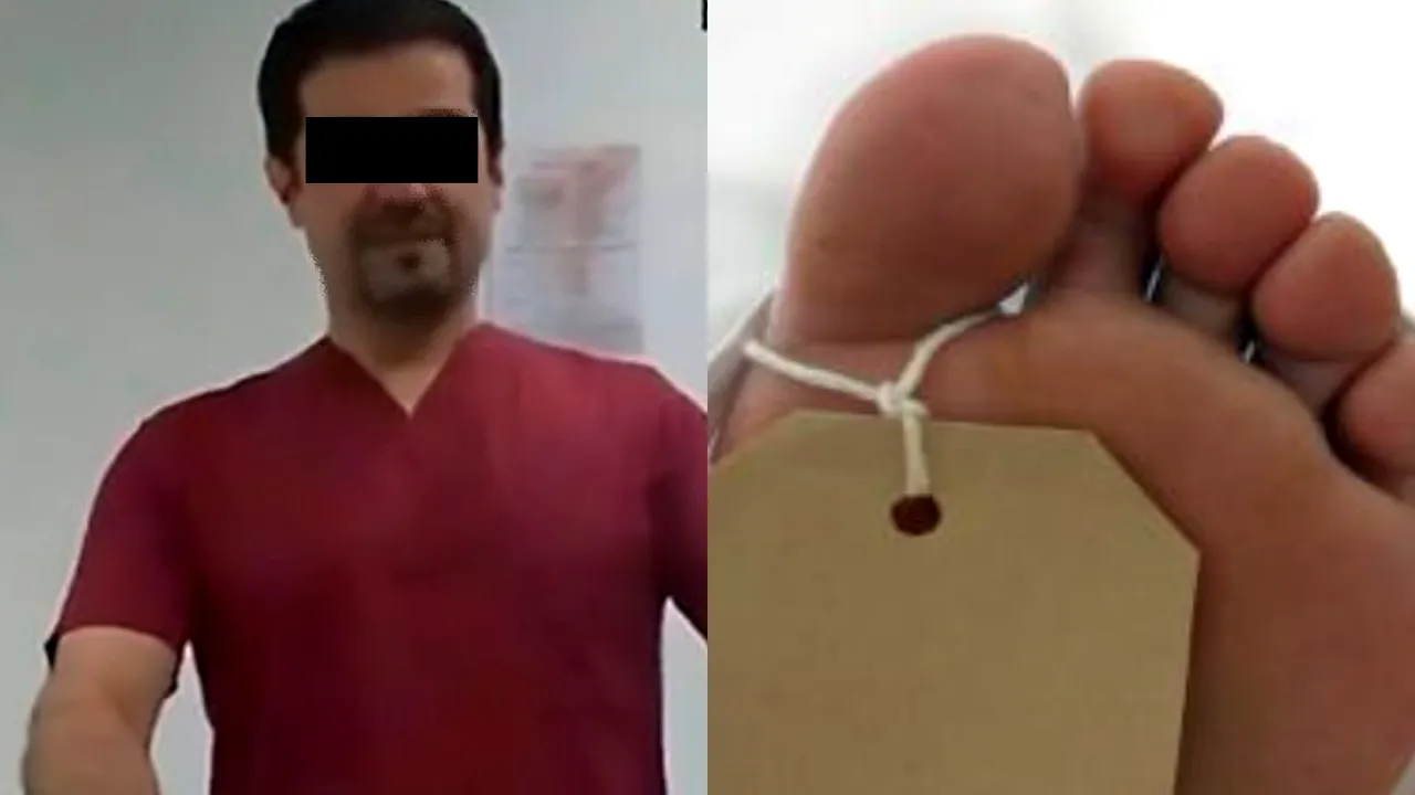 O femeie a murit după o intervenție eșuată de mărire a feselor. Pacienta, operată în Germania de „chirurgul vedetelor