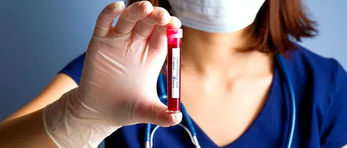 FOCAR DE INFECȚIE. 100 de angajați ai unei brutării din Alba Iulia sunt testați de coronavirus