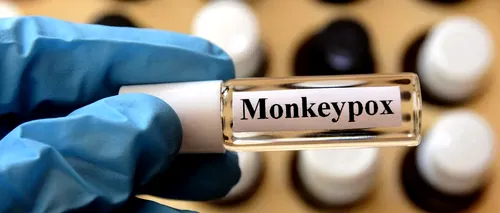 Medicii din Anglia, obligați să anunțe autoritățile când bănuiesc un caz de variola maimuței