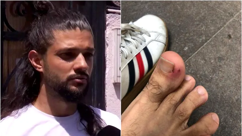 Tânăr mușcat de un șobolan, în centrul Capitalei. Incidentul a avut loc în fața casei sale din zona Piața Romană: „Am dat cu piciorul în el și nu a fugit, nu a avut nicio reacție” / Reacția Primăriei Capitalei