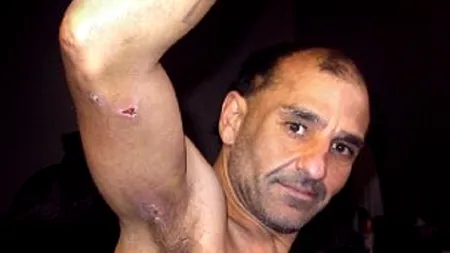 A supraviețuit în mod miraculos după ce a fost strivit într-un malaxor de ciment