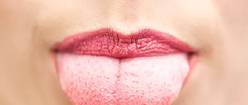 „Dacă observați asta pe limba dumneavoastră, mergeți imediat la medic! Avertisment: cum trădează limba o boală mai gravă 