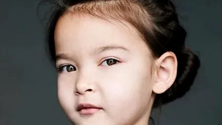 Când diversitatea înseamnă unicitate. 10 copii cu trăsături unice în lume. FOTO